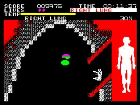 Fantastic Voyage Walkthrough, ZX Spectrum